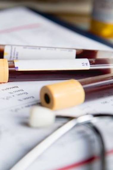 Blood samples in vials sitting on laboratory desk